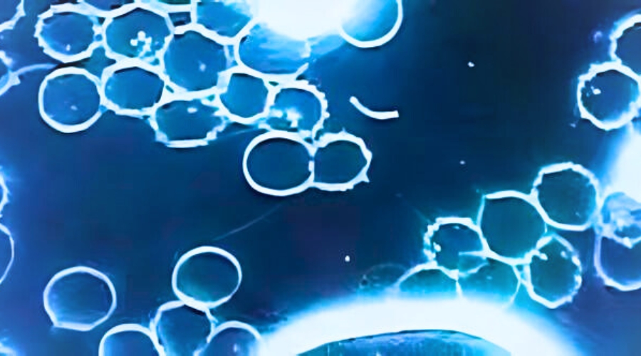 Revista Voix - Nuno Matos - Microscopia de Campo Escuro. https://www.revistavoix.com/wp-content/uploads/2022/03/logo.png - Nuno Matos - Microscopia de Campo Escuro. -