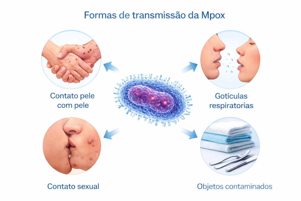 Revista Voix - Mpox: o que é, como se contrai, sintomas, prevenção, vacina e situação mundial. Ilustração explicativa das formas de transmissão da Mpox